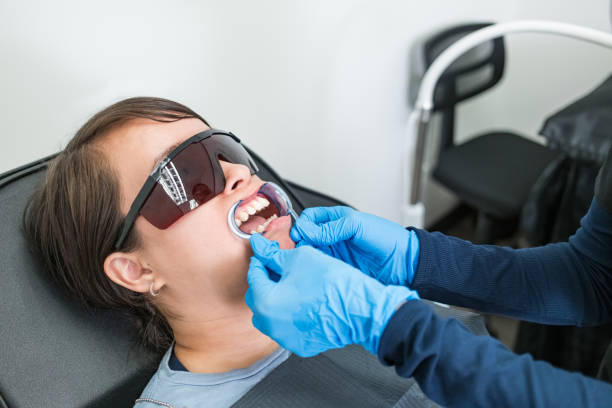 Best Knocked-Out Tooth (Avulsed Tooth) Treatment in USA